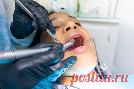 Россиянам назвали неочевидную опасность отбеливающей зубной пасты. Врач-стоматолог Диана Чертанова предупредила, что гели, полоски и другие народные методы отбеливания зубов в домашних условиях вредны для их здоровья. Данные способы помогают снять налет, из-за чего зубы будут казаться светлее. Однако из-за них повреждается эмаль и повышается риск развития кариеса.