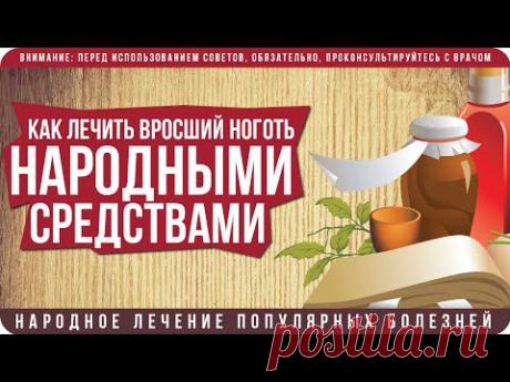 Как лечить вросший ноготь народными средствами в домашних условиях