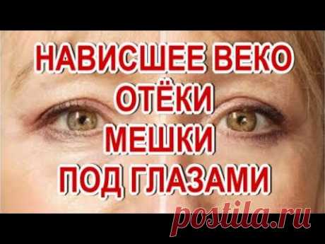 Нависшие Веки❗ Отёки❗ Мешки под Глазами❗ Исчезнут Просто Быстро Навсегда