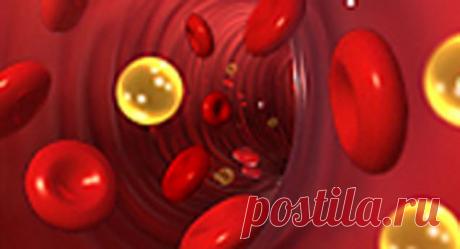 Холестерин. Способы снижения холестерина в крови