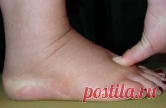 Попрощайтесь с задержкой жидкости, отёками и лишним весом всего за одну неделю с этим удивительным рецептом! Читать далее...