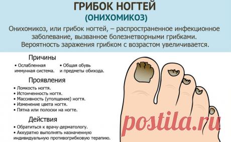 Как устранить запущенный грибок ногтей