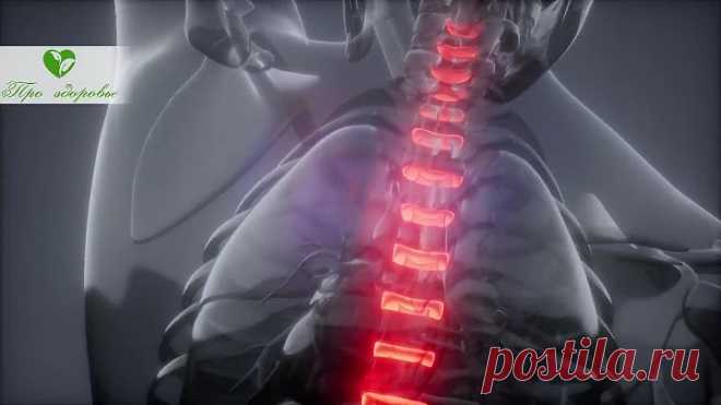 Старый ревматолог рассказал, как быстро избавиться от шейного остеохондроза. Боль в шее