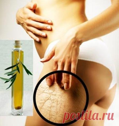 Народные средства от растяжек на коже-Лечение травами, рецепты народной медицины