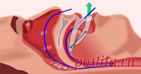 Здоровье - Так просто!