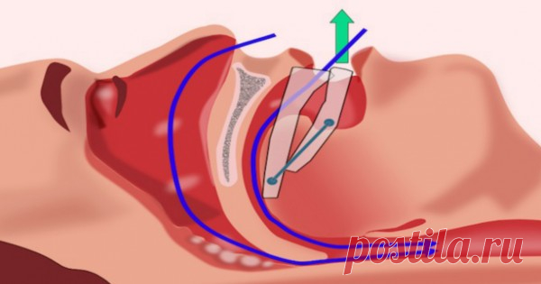 Здоровье - Так просто!