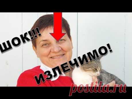 Мои секреты удаления папилломы. Как в домашних условиях вывести папилломы? Чем удалить папиллому?