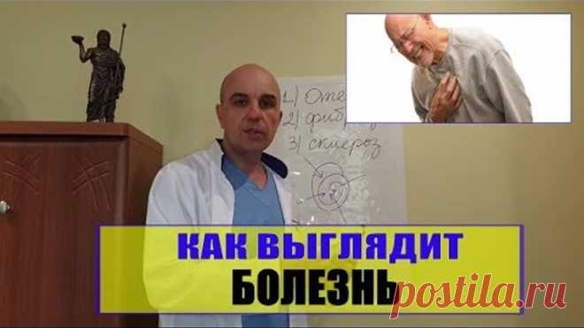 ОСТЕОПАТИЯ Как выглядит Ваша болезнь или что такое дисфункция в теле