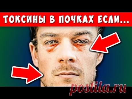 10 Признаков того, что Ваши ПОЧКИ задыхаются от Токсинов!