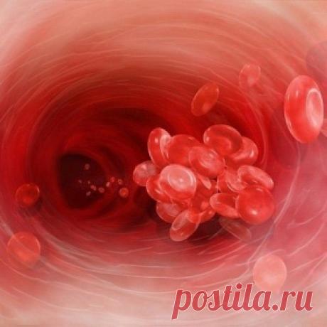 Почему густая кровь опасна? - МирТесен
