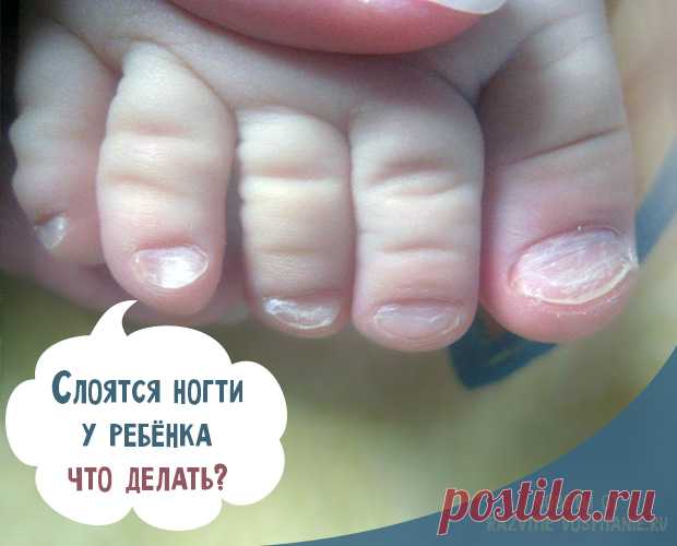 У ребенка слоятся ногти на ногах и на руках: советы Комаровского Почему слоятся ногти на ногах у ребенка? По каким причинам у детей ломаются ноготки на ручках и ножках? Способы лечение расслоившихся ногтей у ребенка.