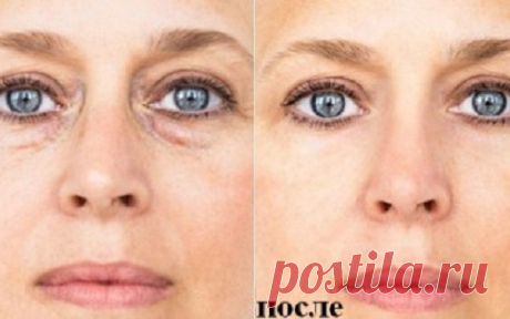 7 советов, которые избавят тебя от мешков под глазами