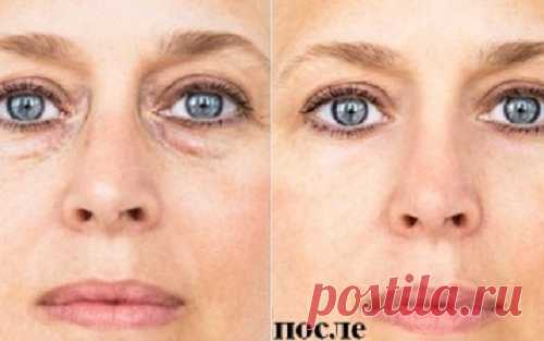 7 советов, которые избавят тебя от мешков под глазами