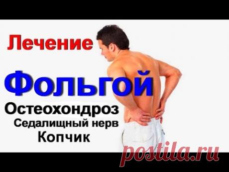Фольга лечит невероятно. Боль в спине. Остеохондроз седалищный нерв, сколиоз, копчик.Лечение фольгой