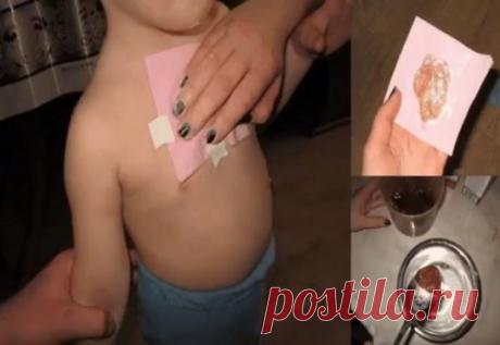 Компресс от сильного кашля! Лечит за вечер.
Хочу поделиться рецептом лепёшки которой всегда пользуюсь при бронхитах:
1 ст. л. мёда,
1 ст. л. сухой горчицы,
1 ст. л. уксуса,
1 ст. л. подсолнечного масла,
муки столько,чтобы можно было лепить.
Лепёшку на грудки или спинку кладу под пелёночку(только не целофан!!!),нужно туго обмотать ребёнка шерстяным шарфом и т.п.на всю ночь.
Как известно, мёд обладает свойствами помогающими лечить многие 
заболевания, не прибегая к использованию традиционных лека