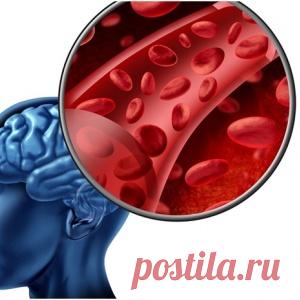 Почему происходит микроинсульт — признаки, лечение, последствия... - МирТесен