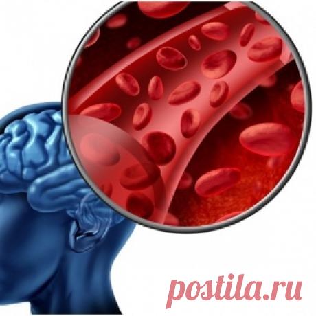 Почему происходит микроинсульт — признаки, лечение, последствия... - МирТесен