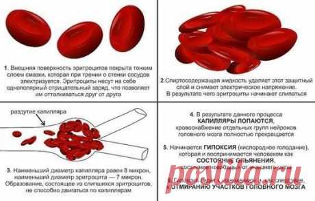 Состояние опьянения - это отмирание клеток мозга.