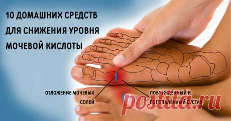 ИЗБАВЬСЯ от мочевой кислоты и вылечи подагру! 10 натуральных средств! Смотрите ВИДЕО!