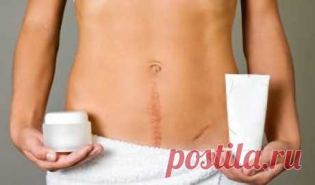 Как убрать шрамы и рубцы после операции в домашних условиях? Как убрать шрамы и рубцы после операции в домашних условиях? Рецепт простого средства. Эту проблему Вам поможет решить обыкновенный горох.