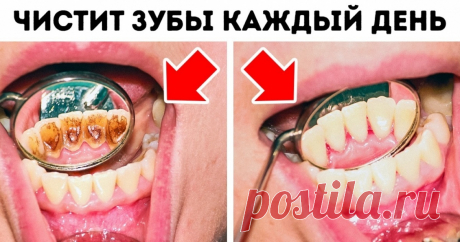 8 ошибок в уходе за зубами, которые совершает каждый из нас Это должно прекратиться.