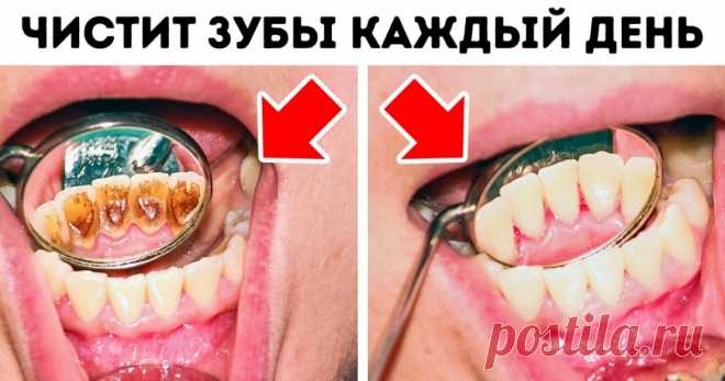 8 ошибок в уходе за зубами, которые совершает каждый из нас Это должно прекратиться.