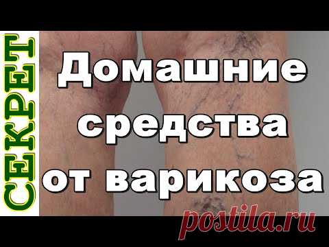 Оказывается, чтобы избавиться от варикоза, можно использовать простой картофель! - Страница 2 из 2