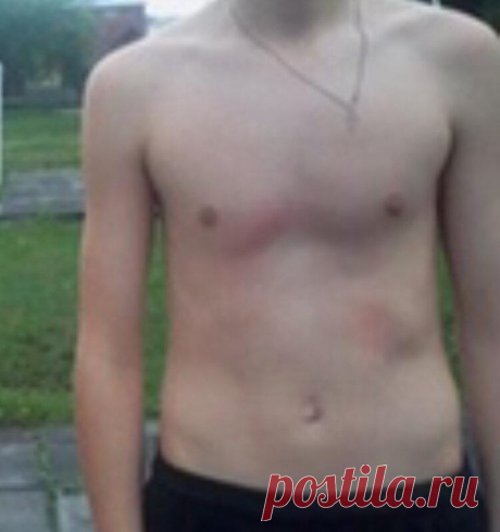 Раньше не верил, что можно похудеть в домашних условиях, но я это сделал и хочу помочь каждому
Моя история давно ещё началась с 2015 года, когда я хотел очень сильно накачаться и начал немного заниматься, но чтобы вы понимали я был очень худым, примерно 52кг при росте 163см. Но во мне это было желание накачаться и начал я с малого, с отжиманий и подтягиваний, на тот момент я подтягивался 2 раза и […]
Читай пост далее на сайте. Жми ⏫ссылку выше