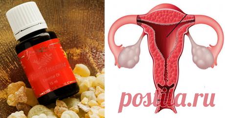 Новые исследования доказали: ладан сильнее, чем химиотерапия в убийстве рака яичников и не только!