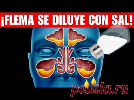 Elimina RÁPIDO la FLEMA en la GARGANTA ¡NO más MOCO!