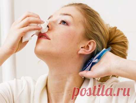 Как остановить носовое кровотечение | Страна Полезных Советов