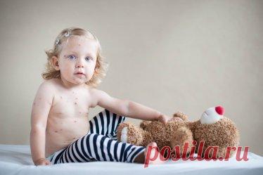Корь возвращается: история о вреде неверия в вакцинацию
