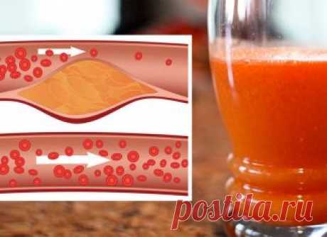 Jedna z najlepších štiav na zníženie cholesterolu, úbytku hmotnosti a zlepšenie spánku - MegaRecepty.sk Zlé stravovacie návyky, nepravidelný spánok a nedostatok pohybu má negatívny dopad na kardiovaskulárne zdravie. Zlý životný štýl je hlavnou príčinou vysokého cholesterolu, ktorý je považovaný za jeden z najtichších a najnebezpečnejších hrozieb. Našťastie jednoduchá zmena vo vašej strave môže ľahko znížiť krvný tlak a hladiny lipidov v krvi. Môžete to urobiť tým, že zahrn...
