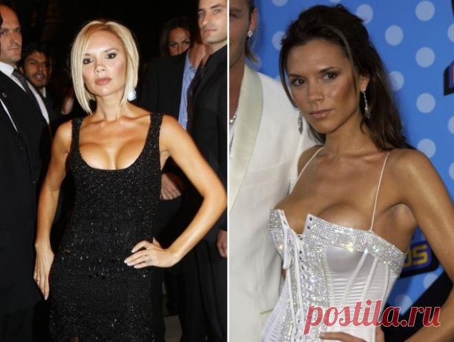 Звезды, которые избавились от силикона