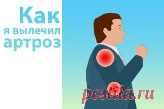 МИНЗДРАВ ЗАЯВЛЯЕТ: Проблемы с суставами — прямой путь к инвалидности