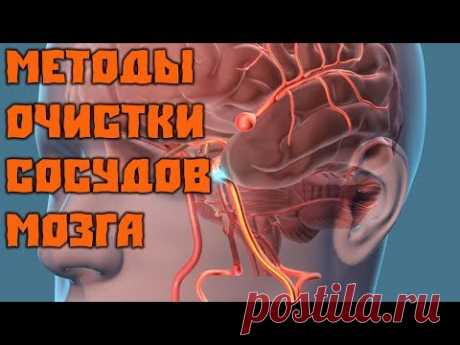 СОСУДЫ КАК В МОЛОДОСТИ! МЕТОДЫ ОЧИСТКИ СОСУДОВ МОЗГА - YouTube