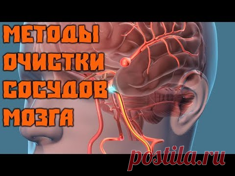 СОСУДЫ КАК В МОЛОДОСТИ! МЕТОДЫ ОЧИСТКИ СОСУДОВ МОЗГА - YouTube