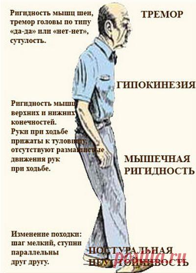 Болезнь Паркинсона: причины, симптомы, лечение
Болезнь Паркинсона: общие причины возникновения этого малоизученного предположительно наследственного заболевания, симптомы, консервативное лечение