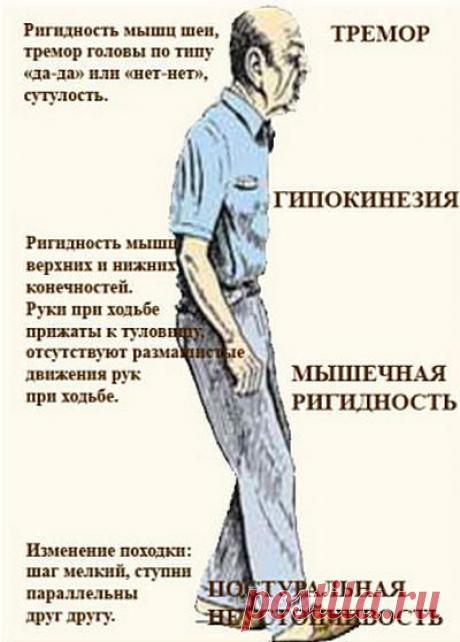 Болезнь Паркинсона: причины, симптомы, лечение
Болезнь Паркинсона: общие причины возникновения этого малоизученного предположительно наследственного заболевания, симптомы, консервативное лечение
