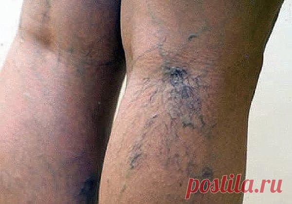 (3) Одноклассники