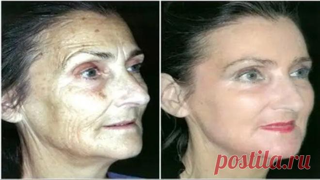 ДАЖЕ САМАЯ ДРЯБЛАЯ КОЖА ЛИЦА ПОДТЯНЕТСЯ ПОСЛЕ ЭТОЙ ПРОЦЕДУРЫ!