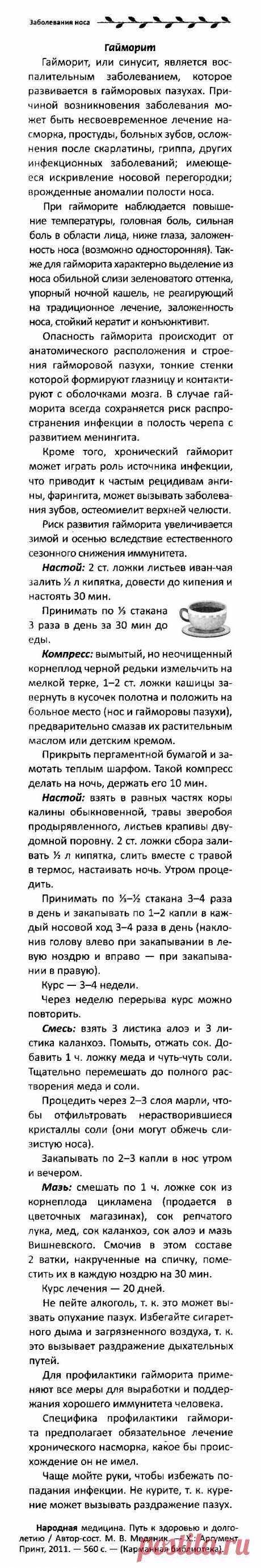 Гайморит