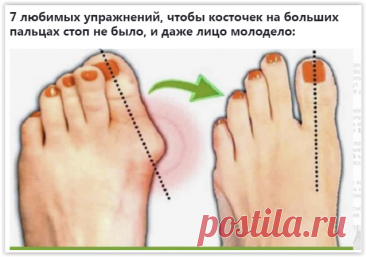 7 расслабляющих упражнений от косточки на ноге!