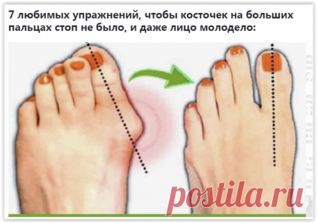 7 расслабляющих упражнений от косточки на ноге!