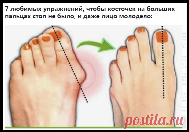 7 расслабляющих упражнений от косточки на ноге!