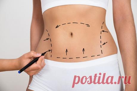 Липоабдоминопластика: что это, особенности процедуры