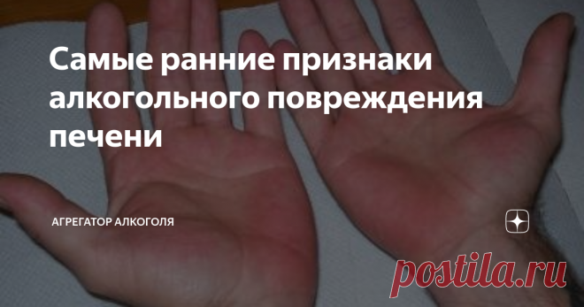 Самые ранние признаки алкогольного повреждения печени Всем здравствуйте! Очень актуальная, после новогодняя статья для Вас.
Печень один из 