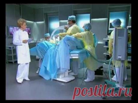 Миома матки: новый метод удаления