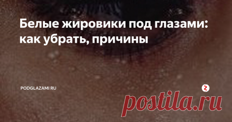 Белые жировики под глазами: как убрать, причины Сегодня речь пойдет о такой медицинской проблеме, как жировики под глазами (их еще называют липомы или милиумы). Проблема, в общем-то, «нестрашная» — это маленькие точечки белого или желтоватого цвета, которые находят себе пристанище на верхнем или нижнем веке. Они не болят и обычно не причиняют неудобств. Но все-таки бороться с ними надо – читайте дальше, и узнаете, почему!