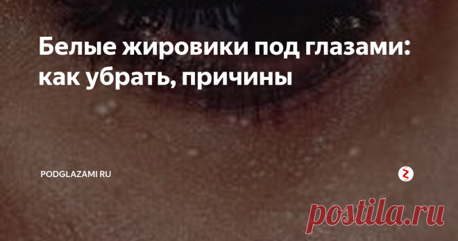 Белые жировики под глазами: как убрать, причины Сегодня речь пойдет о такой медицинской проблеме, как жировики под глазами (их еще называют липомы или милиумы). Проблема, в общем-то, «нестрашная» — это маленькие точечки белого или желтоватого цвета, которые находят себе пристанище на верхнем или нижнем веке. Они не болят и обычно не причиняют неудобств. Но все-таки бороться с ними надо – читайте дальше, и узнаете, почему!